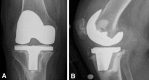 Fig. 5A–B