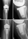 Fig. 6A–D