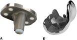 Fig. 1A–B