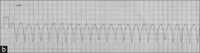 Figure 1b