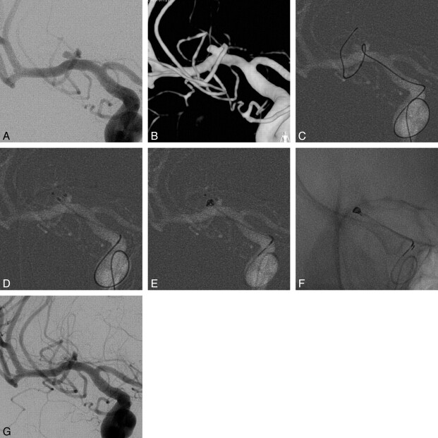 Fig 2.