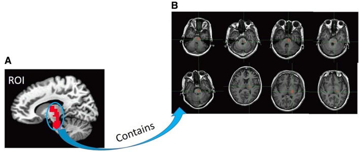 Fig. 1