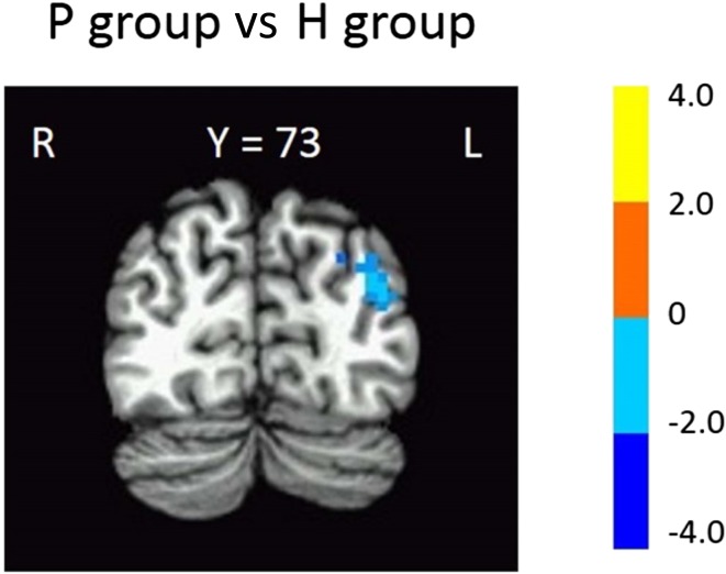 Fig. 2