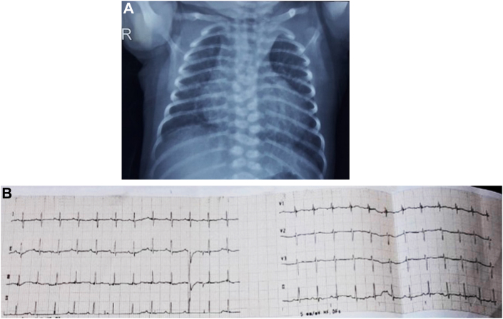 Figure 1