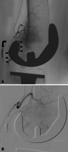 Fig. 1A–B