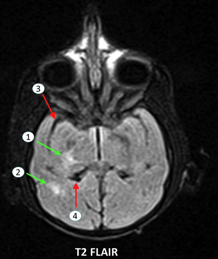 FIG. 1.