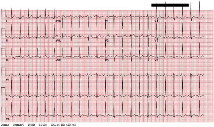 FIGURE 1