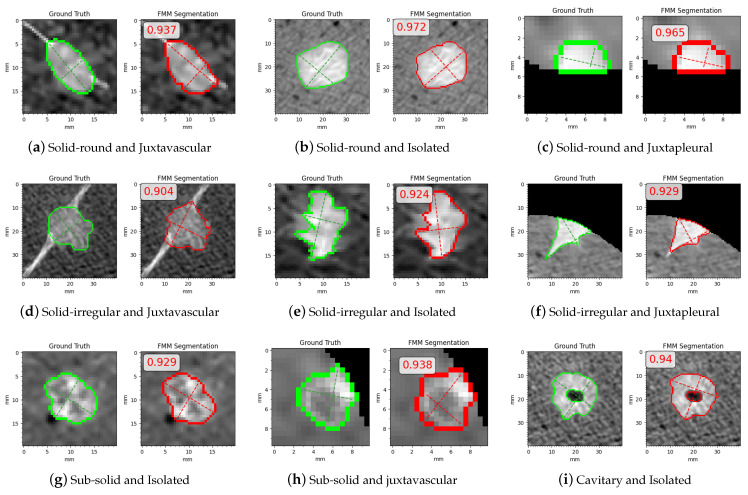 Figure 17