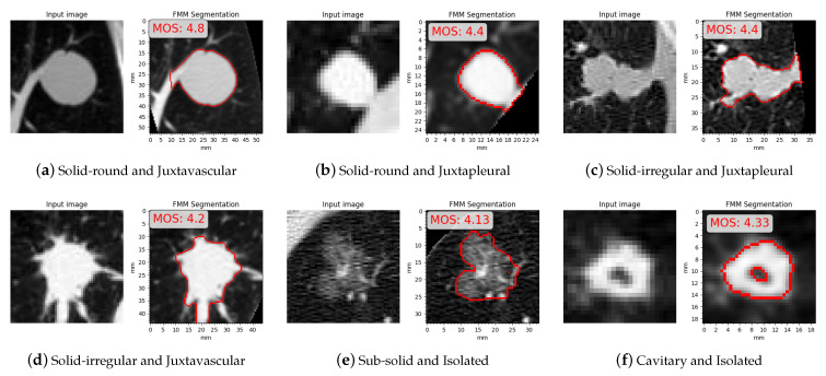 Figure 23