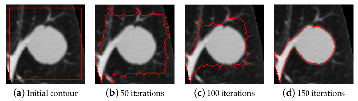 Figure 11