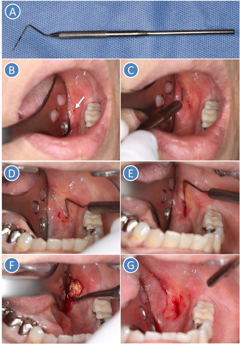 Figure 1