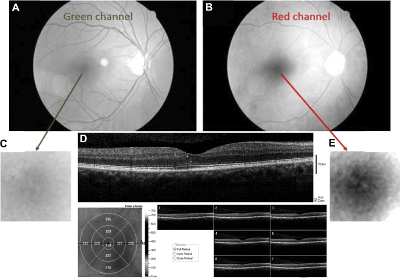 FIGURE 3