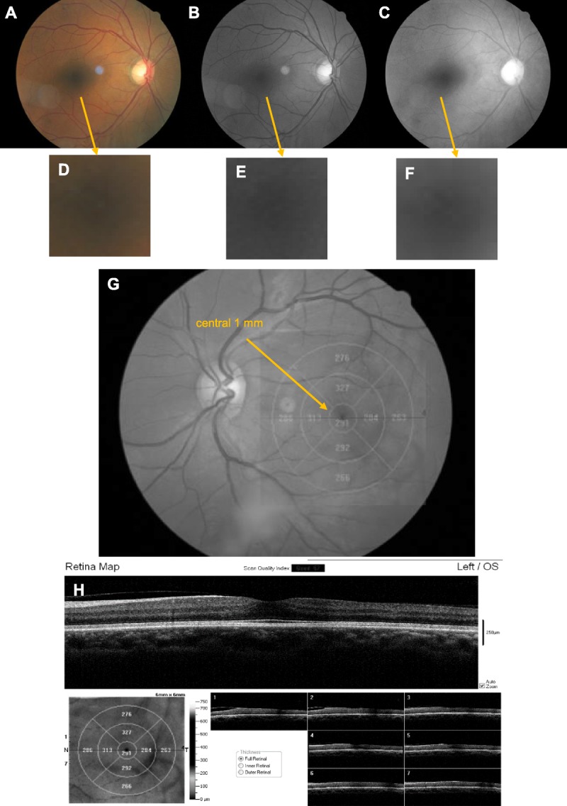 FIGURE 1