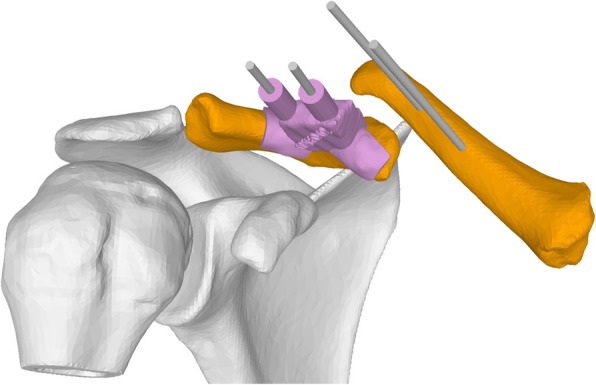 Fig. 4