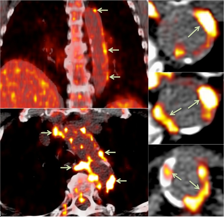 Fig. 2