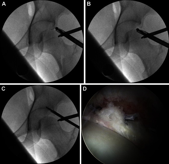 Fig 1