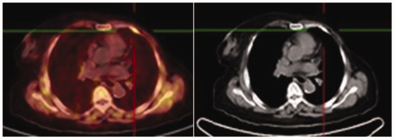 Figure 11.