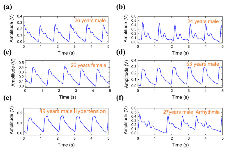 Figure 9