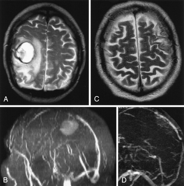 Fig 6.