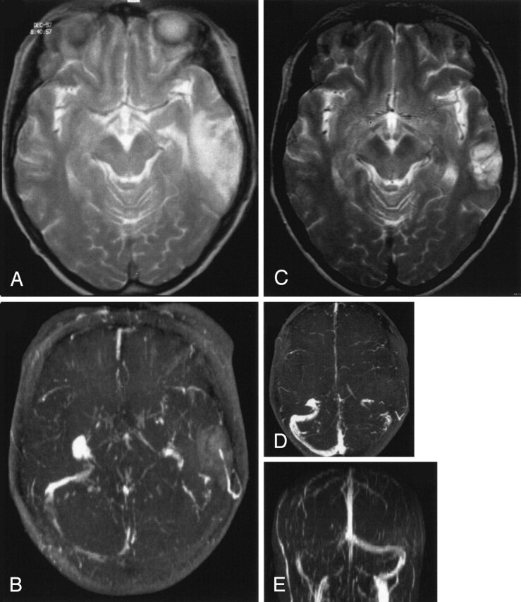 Fig 3.