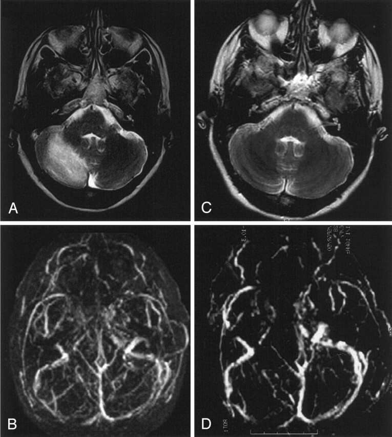 Fig 2.