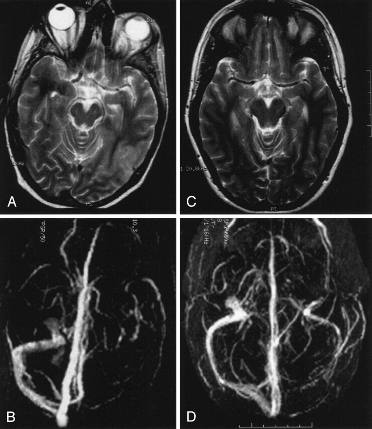 Fig 4.