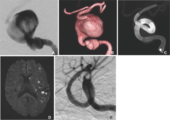 Fig. 2