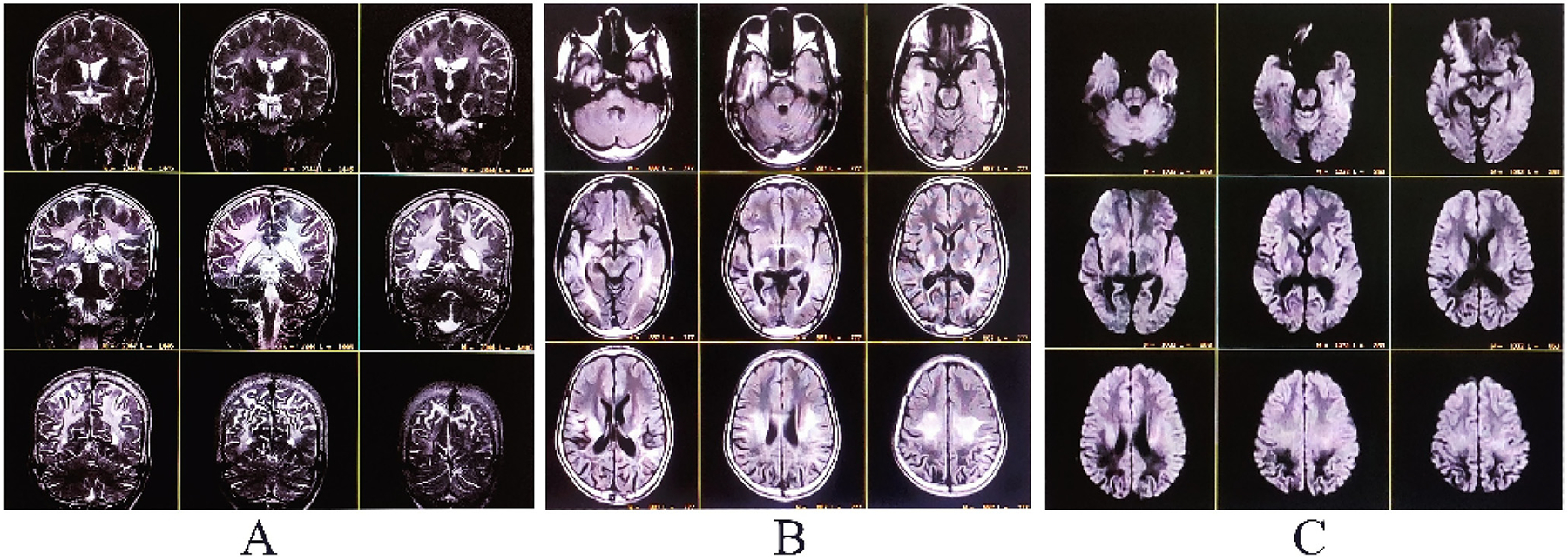 Fig. 1