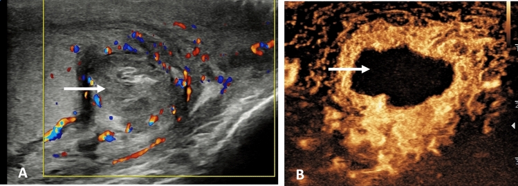 Fig. 9