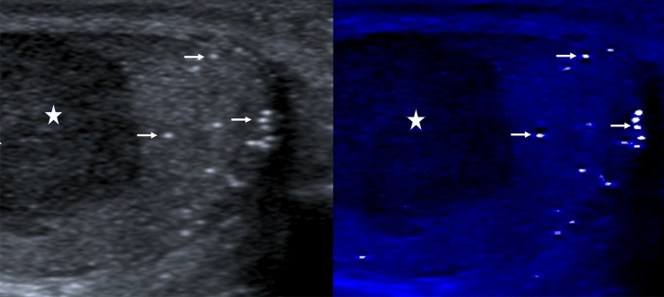 Fig. 12
