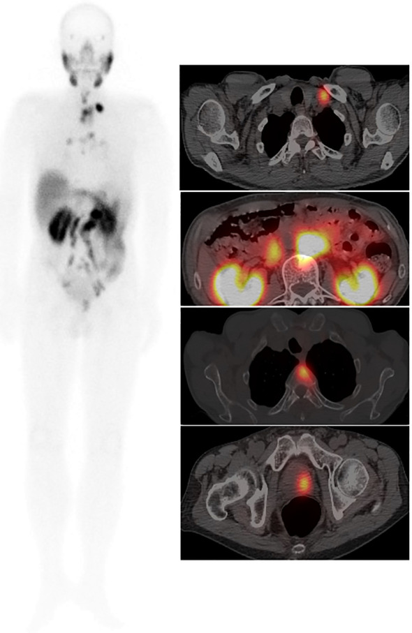 Figure 3