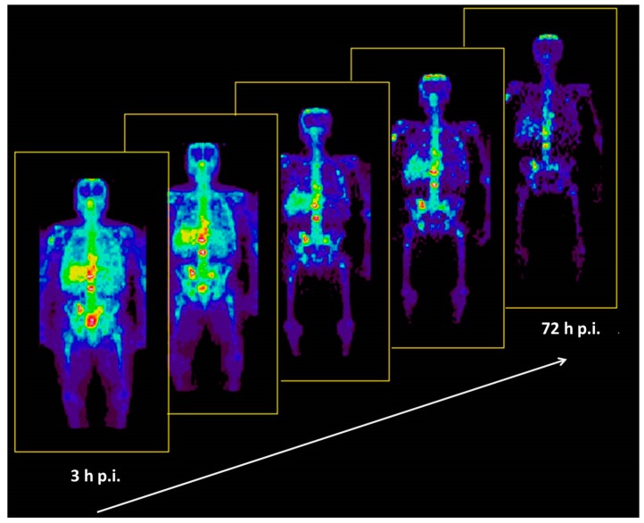 Figure 12