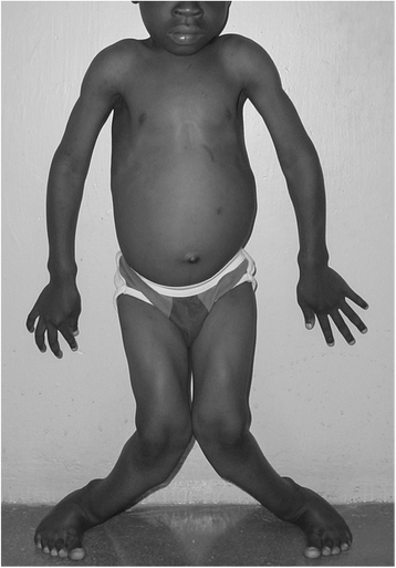 Fig. 1