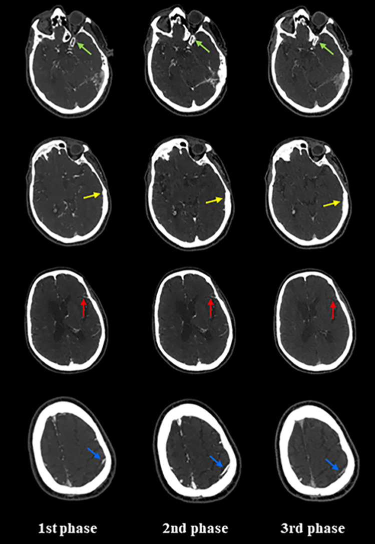 Fig. 5