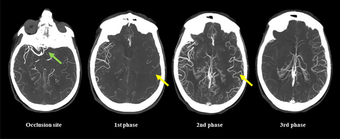 Fig. 4