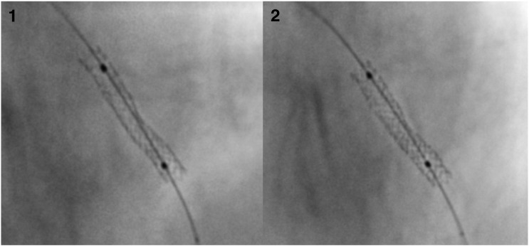 Fig. 3