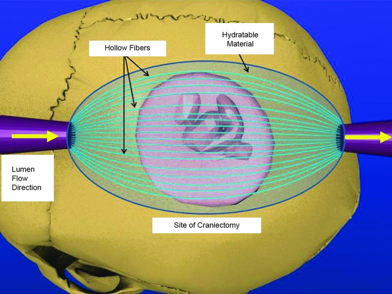 FIG. 1.