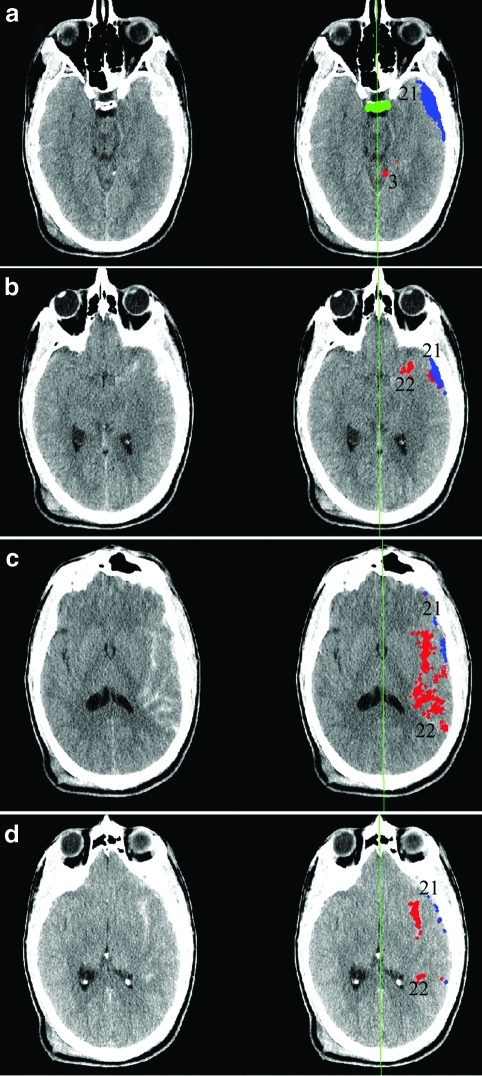 FIG. 1.