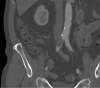 Fig 1