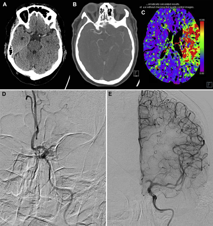 Fig 3