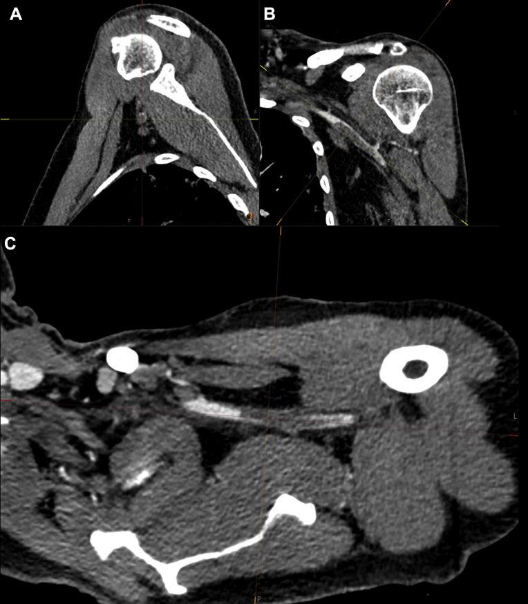 Fig 2