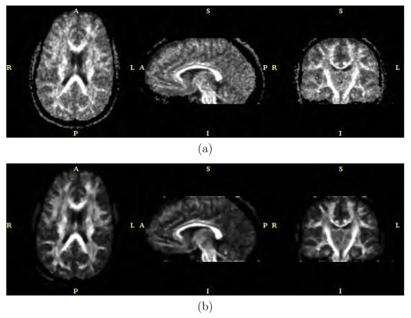 Fig. 11