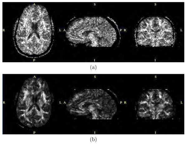 Fig. 12