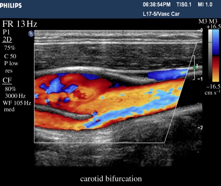 Figure 10.