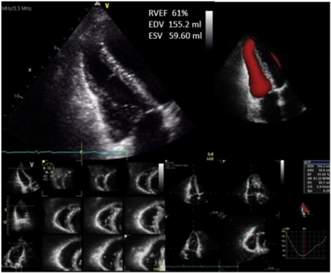 Figure 6