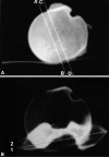 Fig. 2A–B