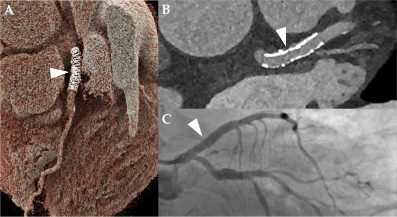 Fig. 4