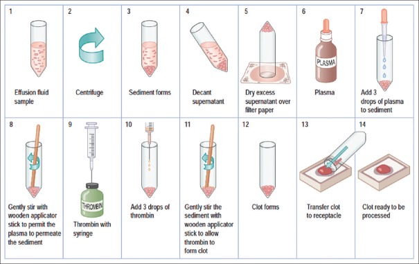 Figure 15