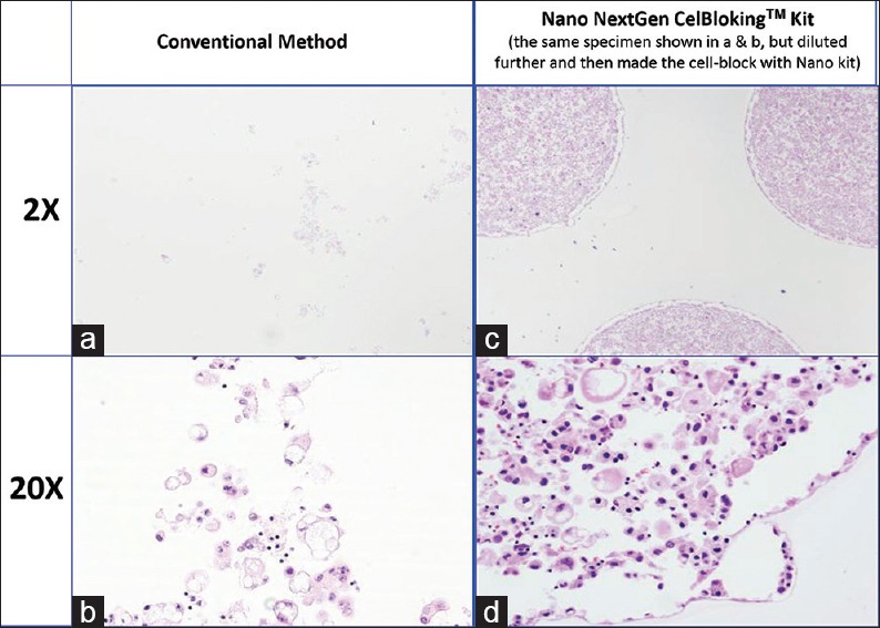 Figure 22