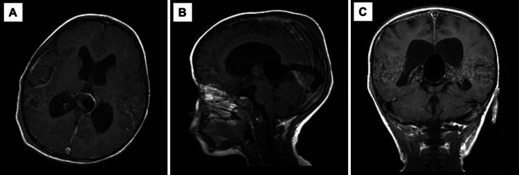 FIG. 2.